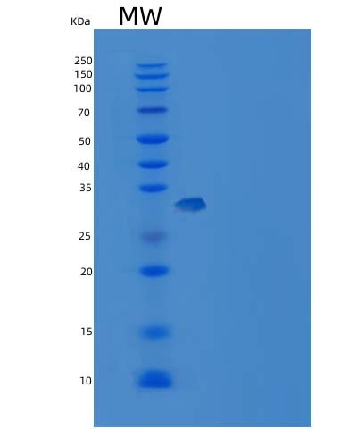 SDS-PAGE analysis of Human CA4 (Carbonic Anhydrase 4) - Recombinant Protein, CAT# BLT-05416P, showing >85% purity under 15% SDS-PAGE (Reduced)Human CA4 (Carbonic Anhydrase 4) - Recombinant Protein