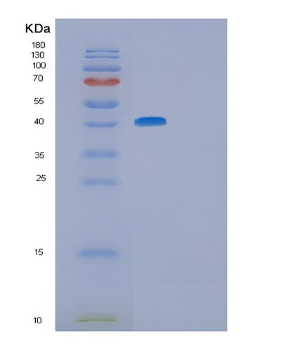 SDS-PAGE analysis of Human GFRA3 (Gdnf Family Receptor Alpha-3) - Recombinant Protein, CAT# BLT-01190P, showing >85% purity under 15% SDS-PAGE (Reduced)Human GFRA3 (Gdnf Family Receptor Alpha-3) - Recombinant Protein