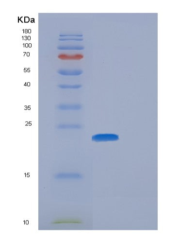 SDS-PAGE analysis of Human GGCT (Gamma-Glutamylcyclotransferase) - Recombinant Protein, CATHuman GGCT (Gamma-Glutamylcyclotransferase) - Recombinant Protein