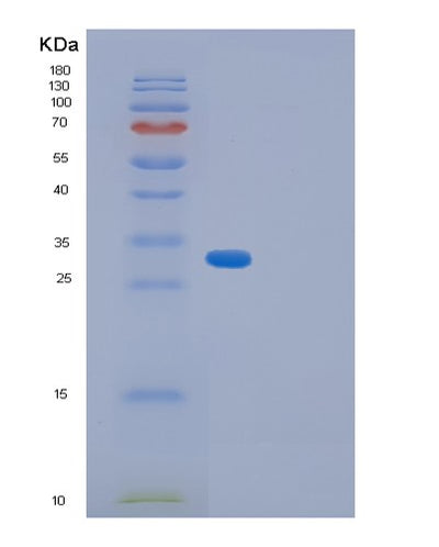 SDS-PAGE analysis of Human GID8 (Glucose-Induced Degradation Protein 8 Homolog) - Recombinant Protein, CAT# BLT-01195P, showing >90% purity under 15% SDS-PAGE (Reduced)Human GID8 (Glucose-Induced Degradation Protein 8 Homolog) - Recombinant Protein