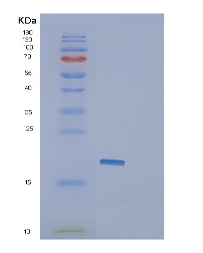 SDS-PAGE analysis of Human GLIPR2 (Golgi-Associated Plant Pathogenesis-Related Protein 1) - Recombinant Protein, CATHuman GLIPR2 (Golgi-Associated Plant Pathogenesis-Related Protein 1) - Recombinant Protein