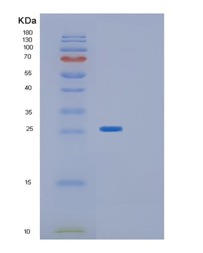SDS-PAGE analysis of Human CPTP (Ceramide-1-Phosphate Transfer Protein) - Recombinant Protein, CAT# BLT-01209P, showing >85% purity under 15% SDS-PAGE (Reduced)Human CPTP (Ceramide-1-Phosphate Transfer Protein) - Recombinant Protein