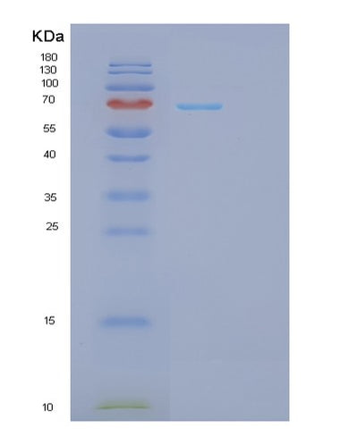 SDS-PAGE analysis of Human GPI (Glucose-6-Phosphate Isomerase) - Recombinant Protein, CAT# BLT-01262P, showing >95% purity under 15% SDS-PAGE (Reduced)Human GPI (Glucose-6-Phosphate Isomerase) - Recombinant Protein