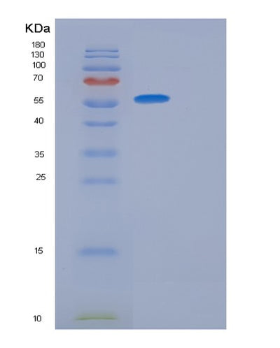 SDS-PAGE analysis of Human DPAGT1 (Udp-N-Acetylglucosamine--Dolichyl-Phosphate N-Acetylglucosaminephosphotransferase) - Recombinant Protein, CAT# BLT-01266P, showing >90% purity under 15% SDS-PAGE (Reduced)Human DPAGT1 (Udp-N-Acetylglucosamine--Dolichyl-Phosphate N-Acetylglucosaminephosphotransferase) - Recombinant Protein