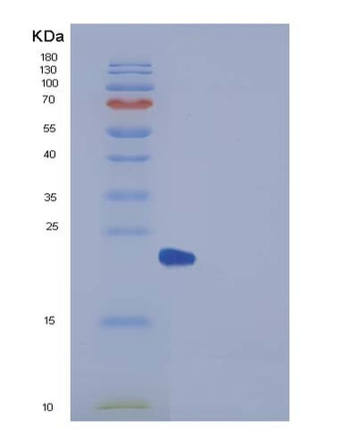 SDS-PAGE analysis of Human UBE2H (Ubiquitin-Conjugating Enzyme E2 H) - Recombinant Protein, CAT# BLT-04376P, showing >95% purity under 15% SDS-PAGE (Reduced)Human UBE2H (Ubiquitin-Conjugating Enzyme E2 H) - Recombinant Protein