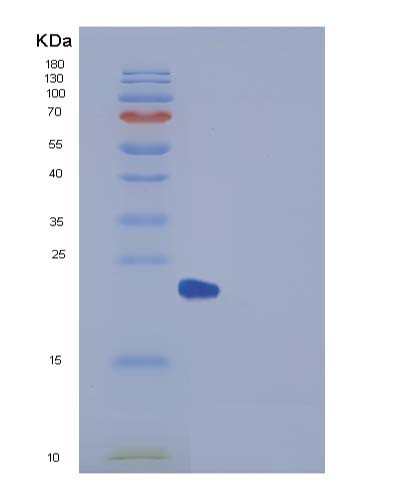 SDS-PAGE analysis of Human UBE2H (Ubiquitin-Conjugating Enzyme E2 H) - Recombinant Protein, CATHuman UBE2H (Ubiquitin-Conjugating Enzyme E2 H) - Recombinant Protein