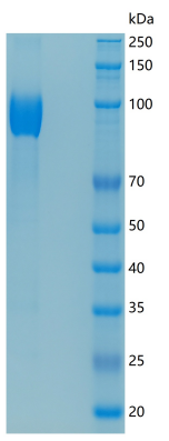 SDS-PAGE analysis of Mouse Nt5e (5'-Nucleotidase) - Recombinant Protein, CAT# BLT-06531P, showing >85% purity under 15% SDS-PAGE (Reduced)Mouse Nt5e (5'-Nucleotidase) - Recombinant Protein