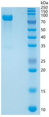 SDS-PAGE analysis of Human SLITRK1 (Slit And Ntrk-Like Protein 1) - Recombinant Protein, CAT# BLT-06705P, showing >90% purity under 15% SDS-PAGE (Reduced)Human SLITRK1 (Slit And Ntrk-Like Protein 1) - Recombinant Protein
