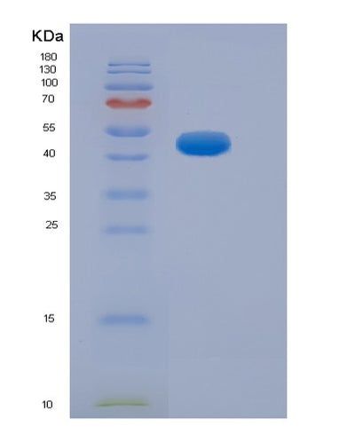 SDS-PAGE analysis of Human NEFH (Neurofilament Heavy Polypeptide) - Recombinant Protein, CAT# BLT-07123P, showing >95% purity under 15% SDS-PAGE (Reduced)Human NEFH (Neurofilament Heavy Polypeptide) - Recombinant Protein