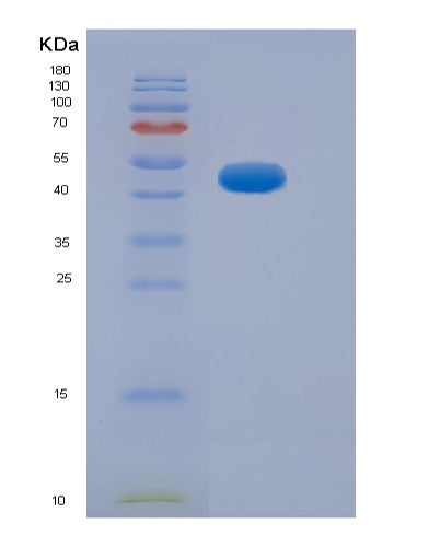 SDS-PAGE analysis of Human NEFH (Neurofilament Heavy Polypeptide) - Recombinant Protein, CATHuman NEFH (Neurofilament Heavy Polypeptide) - Recombinant Protein