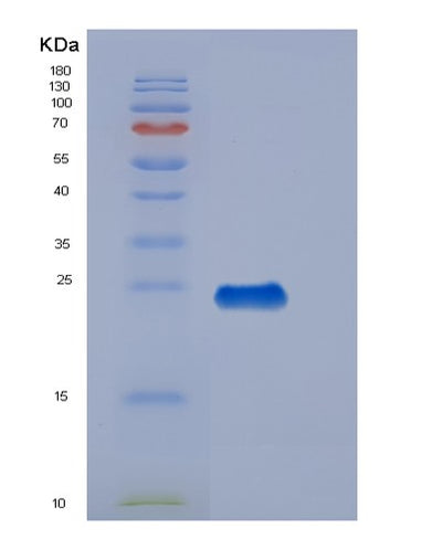 SDS-PAGE analysis of Human THBD (Thrombomodulin) - Recombinant Protein, CAT# BLT-07124P, showing >95% purity under 15% SDS-PAGE (Reduced)Human THBD (Thrombomodulin) - Recombinant Protein