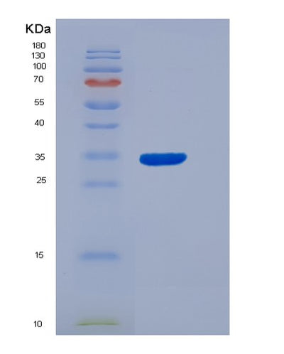 SDS-PAGE analysis of Human AHR (Aryl Hydrocarbon Receptor) - Recombinant Protein, CAT# BLT-07125P, showing >95% purity under 15% SDS-PAGE (Reduced)Human AHR (Aryl Hydrocarbon Receptor) - Recombinant Protein
