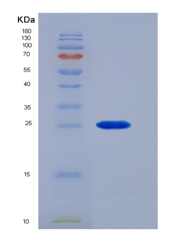 SDS-PAGE analysis of Mouse Csf1r (Macrophage Colony-Stimulating Factor 1 Receptor) - Recombinant Protein, CATMouse Csf1r (Macrophage Colony-Stimulating Factor 1 Receptor) - Recombinant Protein