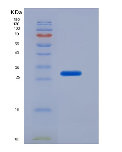 SDS-PAGE analysis of Human ACTB (Actin, Cytoplasmic 1) - Recombinant Protein, CAT# BLT-07131P, showing >95% purity under 15% SDS-PAGE (Reduced)Human ACTB (Actin, Cytoplasmic 1) - Recombinant Protein