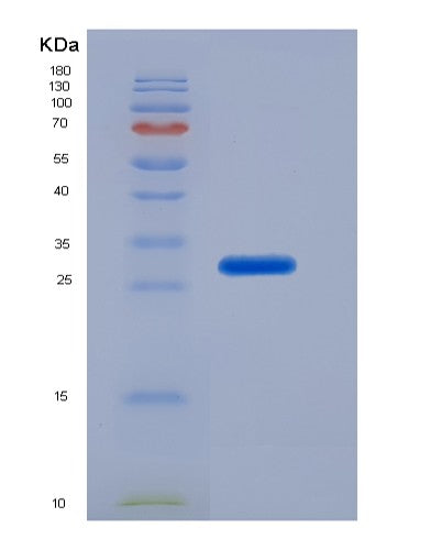 SDS-PAGE analysis of Human ACTB (Actin, Cytoplasmic 1) - Recombinant Protein, CATHuman ACTB (Actin, Cytoplasmic 1) - Recombinant Protein