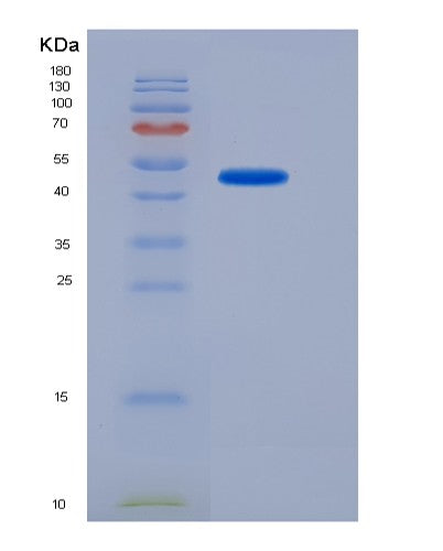 SDS-PAGE analysis of Human USP7 (Ubiquitin Carboxyl-Terminal Hydrolase 7) - Recombinant Protein, CATHuman USP7 (Ubiquitin Carboxyl-Terminal Hydrolase 7) - Recombinant Protein