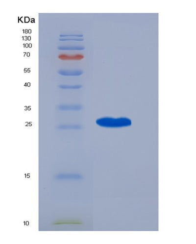 SDS-PAGE analysis of Human CENPF (Centromere Protein F) - Recombinant Protein, CAT# BLT-07135P, showing >95% purity under 15% SDS-PAGE (Reduced)Human CENPF (Centromere Protein F) - Recombinant Protein
