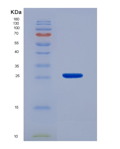 SDS-PAGE analysis of Human LGALS3 (Galectin-3) - Recombinant Protein, CATHuman LGALS3 (Galectin-3) - Recombinant Protein