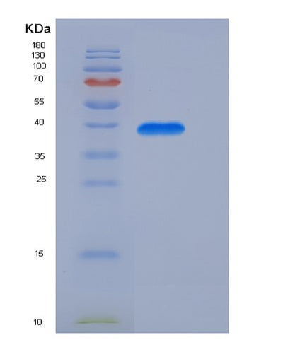 SDS-PAGE analysis of Human INS (Insulin) - Recombinant Protein, CAT# BLT-07139P, showing >95% purity under 15% SDS-PAGE (Reduced)Human INS (Insulin) - Recombinant Protein