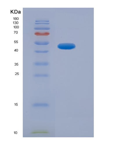 SDS-PAGE analysis of Human NFE2L2 (Nuclear Factor Erythroid 2-Related Factor 2) - Recombinant Protein, CAT# BLT-07141P, showing >95% purity under 15% SDS-PAGE (Reduced)Human NFE2L2 (Nuclear Factor Erythroid 2-Related Factor 2) - Recombinant Protein