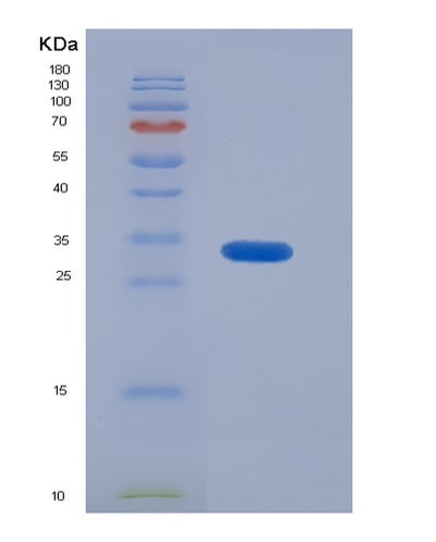 SDS-PAGE analysis of Human CALCA (Calcitonin) - Recombinant Protein, CAT# BLT-07144P, showing >90% purity under 15% SDS-PAGE (Reduced)Human CALCA (Calcitonin) - Recombinant Protein