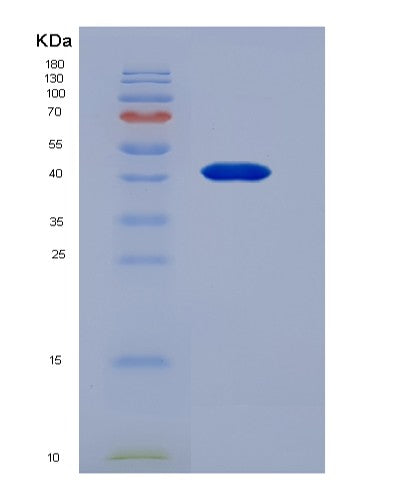 SDS-PAGE analysis of Human Resistin Like Beta (RETNLb) - Recombinant Protein, CATHuman Resistin Like Beta (RETNLb) - Recombinant Protein