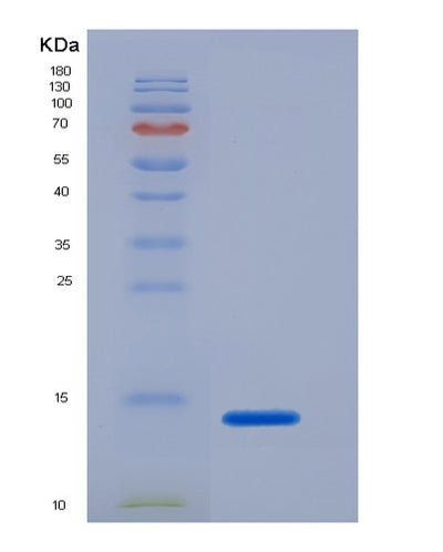 SDS-PAGE analysis of Mouse Tubgcp2 (Gamma-Tubulin Complex Component 2) - Recombinant Protein, CAT# BLT-07148P, showing >95% purity under 15% SDS-PAGE (Reduced)Mouse Tubgcp2 (Gamma-Tubulin Complex Component 2) - Recombinant Protein