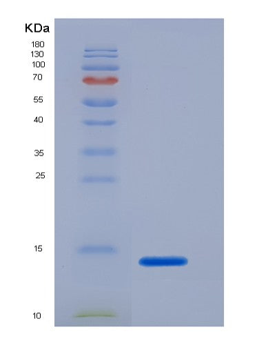 SDS-PAGE analysis of Mouse Tubgcp2 (Gamma-Tubulin Complex Component 2) - Recombinant Protein, CATMouse Tubgcp2 (Gamma-Tubulin Complex Component 2) - Recombinant Protein
