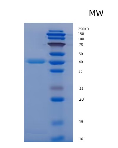 SDS-PAGE analysis of Human FGL1 (Fibrinogen-Like Protein 1) - Recombinant Protein, CAT# BLT-07150P, showing >90% purity under 15% SDS-PAGE (Reduced)Human FGL1 (Fibrinogen-Like Protein 1) - Recombinant Protein