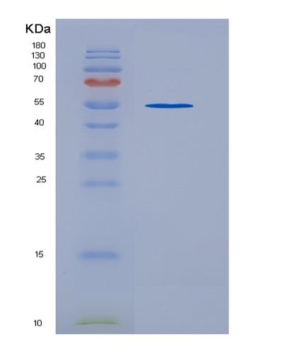 SDS-PAGE analysis of Human TEK (Angiopoietin-1 Receptor) - Recombinant Protein, CAT# BLT-07152P, showing >80% purity under 15% SDS-PAGE (Reduced)Human TEK (Angiopoietin-1 Receptor) - Recombinant Protein