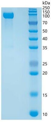SDS-PAGE analysis of Human GLB1 (Beta-Galactosidase) - Recombinant Protein, CAT# BLT-08440P showing >95% purity under 15% SDS-PAGE (Reduced)Human GLB1 (Beta-Galactosidase) - Recombinant Protein