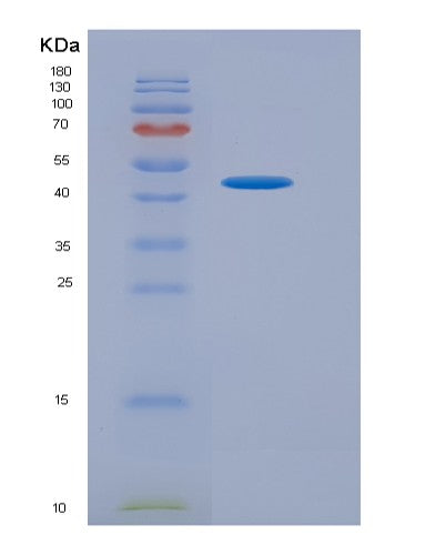 SDS-PAGE analysis of Human GABBR1 (Gamma-Aminobutyric Acid Type B Receptor Subunit 1) - Recombinant Protein, CATHuman GABBR1 (Gamma-Aminobutyric Acid Type B Receptor Subunit 1) - Recombinant Protein