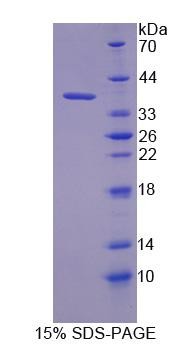 SDS-PAGE analysis of Human KEAP1 (Kelch-Like Ech-Associated Protein 1) - Recombinant Protein, CAT# BLT-06659P, showing >90% purity under 15% SDS-PAGE (Reduced)Human KEAP1 (Kelch-Like Ech-Associated Protein 1) - Recombinant Protein