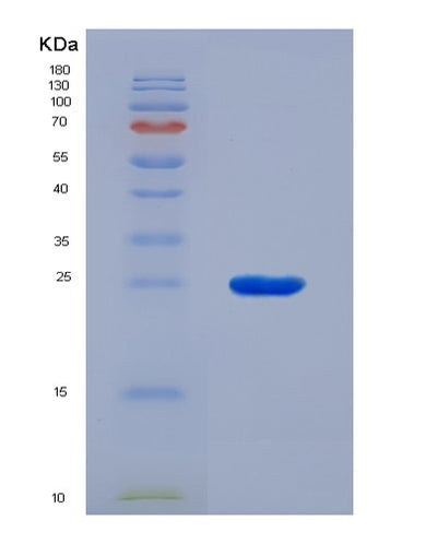 SDS-PAGE analysis of Human MMP9 (Matrix Metalloproteinase-9) - Recombinant Protein, CAT# BLT-07165P, showing >95% purity under 15% SDS-PAGE (Reduced)Human MMP9 (Matrix Metalloproteinase-9) - Recombinant Protein