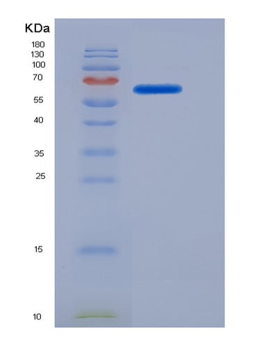 SDS-PAGE analysis of Human MAOA (Amine Oxidase [Flavin-Containing] A) - Recombinant Protein, CAT# BLT-07172P, showing >90% purity under 15% SDS-PAGE (Reduced)Human MAOA (Amine Oxidase [Flavin-Containing] A) - Recombinant Protein