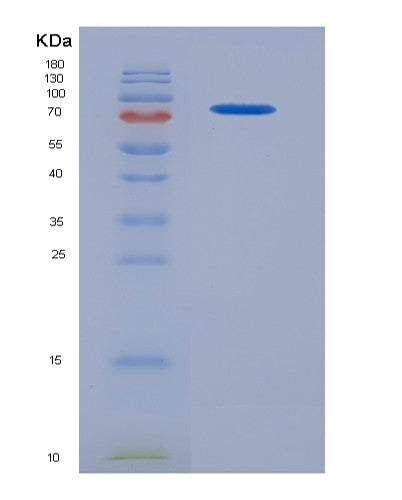 SDS-PAGE analysis of Human CSF1 (Macrophage Colony-Stimulating Factor 1) - Recombinant Protein, CATHuman CSF1 (Macrophage Colony-Stimulating Factor 1) - Recombinant Protein