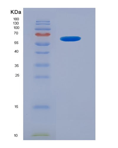 SDS-PAGE analysis of Mouse Klk1 (Kallikrein-1) - Recombinant Protein, CAT# BLT-07178P, showing >95% purity under 15% SDS-PAGE (Reduced)Mouse Klk1 (Kallikrein-1) - Recombinant Protein
