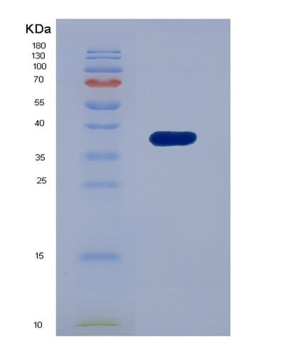 SDS-PAGE analysis of Human IFI35 (Interferon-Induced 35 Kda Protein) - Recombinant Protein, CAT# BLT-07179P, showing >95% purity under 15% SDS-PAGE (Reduced)Human IFI35 (Interferon-Induced 35 Kda Protein) - Recombinant Protein