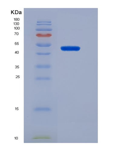 SDS-PAGE analysis of Mouse Mdm2 (E3 Ubiquitin-Protein Ligase Mdm2) - Recombinant Protein, CAT# BLT-07180P, showing >95% purity under 15% SDS-PAGE (Reduced)Mouse Mdm2 (E3 Ubiquitin-Protein Ligase Mdm2) - Recombinant Protein
