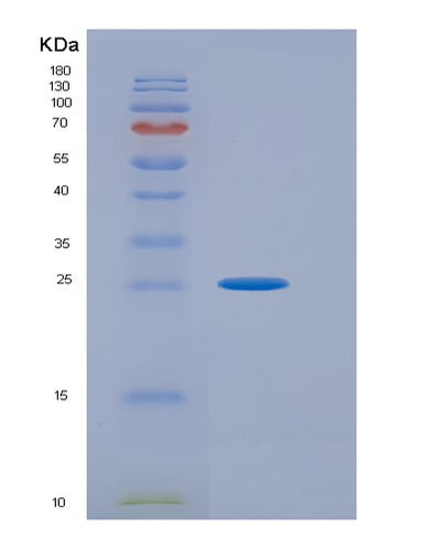 SDS-PAGE analysis of Human ATF1 (Cyclic Amp-Dependent Transcription Factor Atf-1) - Recombinant Protein, CAT# BLT-00249P, showing >95% purity under 15% SDS-PAGE (Reduced)Human ATF1 (Cyclic Amp-Dependent Transcription Factor Atf-1) - Recombinant Protein