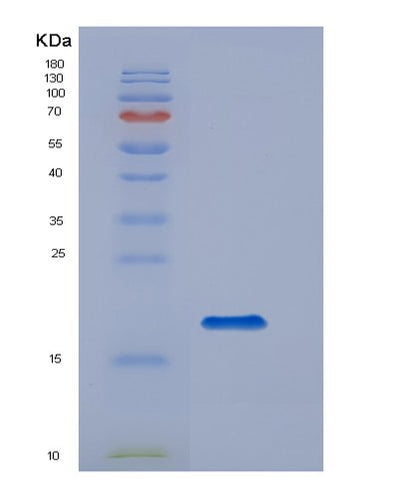 SDS-PAGE analysis of Human CD14 (Monocyte Differentiation Antigen Cd14) - Recombinant Protein, CAT# BLT-00462P, showing >95% purity under 15% SDS-PAGE (Reduced)Human CD14 (Monocyte Differentiation Antigen Cd14) - Recombinant Protein