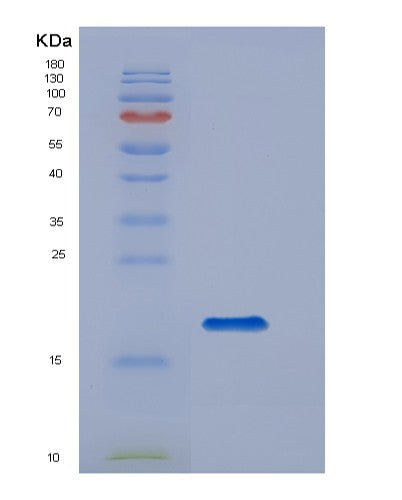 SDS-PAGE analysis of Human CD14 (Monocyte Differentiation Antigen Cd14) - Recombinant Protein, CATHuman CD14 (Monocyte Differentiation Antigen Cd14) - Recombinant Protein