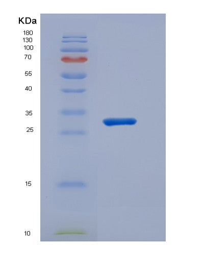 SDS-PAGE analysis of Human CD1E (T-Cell Surface Glycoprotein Cd1E, Membrane-Associated) - Recombinant Protein, CATHuman CD1E (T-Cell Surface Glycoprotein Cd1E, Membrane-Associated) - Recombinant Protein