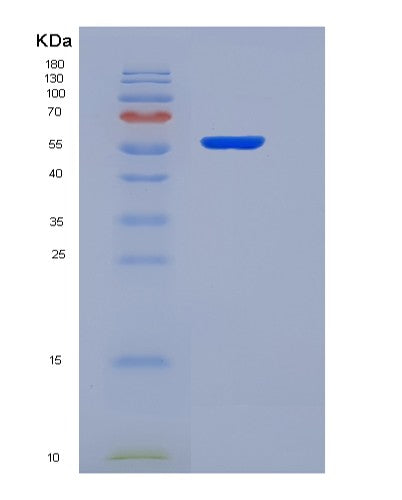 SDS-PAGE analysis of Human NR4A1 (Nuclear Receptor Subfamily 4Immunitygroup A Member 1) - Recombinant Protein, CATHuman NR4A1 (Nuclear Receptor Subfamily 4Immunitygroup A Member 1) - Recombinant Protein