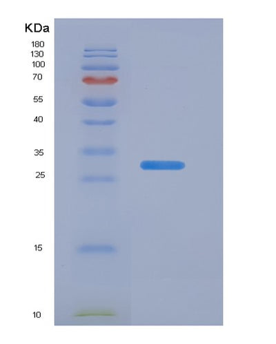 SDS-PAGE analysis of Human F2 (Prothrombin) - Recombinant Protein, CAT# BLT-07182P, showing >95% purity under 15% SDS-PAGE (Reduced)Human F2 (Prothrombin) - Recombinant Protein