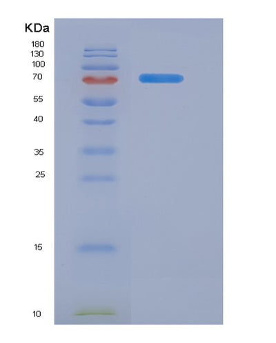 SDS-PAGE analysis of Human AFP (Alpha-Fetoprotein) - Recombinant Protein, CAT# BLT-07183P, showing >90% purity under 15% SDS-PAGE (Reduced)Human AFP (Alpha-Fetoprotein) - Recombinant Protein