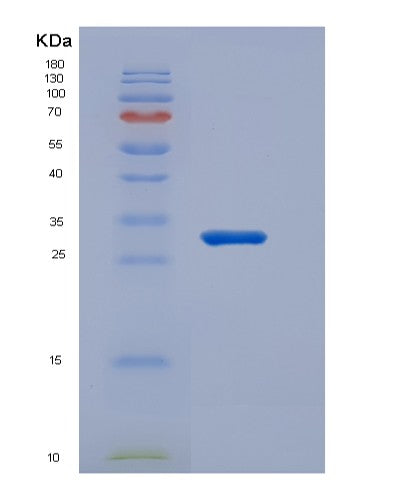 SDS-PAGE analysis of Human CD226 (Cd226 Antigen) - Recombinant Protein, CATHuman CD226 (Cd226 Antigen) - Recombinant Protein