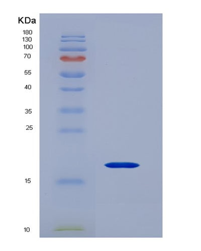 SDS-PAGE analysis of Human CD247 (T-Cell Surface Glycoprotein Cd3 Zeta Chain) - Recombinant Protein, CAT# BLT-00479P, showing >95% purity under 15% SDS-PAGE (Reduced)Human CD247 (T-Cell Surface Glycoprotein Cd3 Zeta Chain) - Recombinant Protein