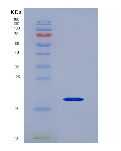 SDS-PAGE analysis of Human CD247 (T-Cell Surface Glycoprotein Cd3 Zeta Chain) - Recombinant Protein, CATHuman CD247 (T-Cell Surface Glycoprotein Cd3 Zeta Chain) - Recombinant Protein