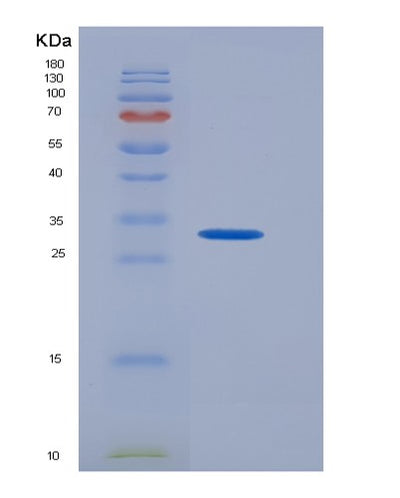 SDS-PAGE analysis of Human CD274 (Programmed Cell Death 1 Ligand 1) - Recombinant Protein, CAT# BLT-00482P, showing >90% purity under 15% SDS-PAGE (Reduced)Human CD274 (Programmed Cell Death 1 Ligand 1) - Recombinant Protein